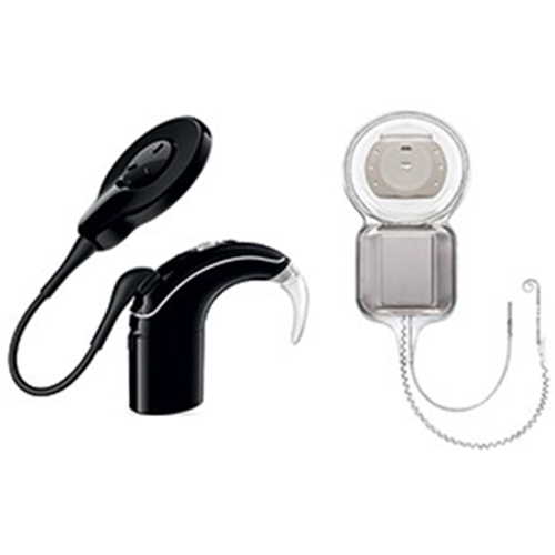 cochlear implants